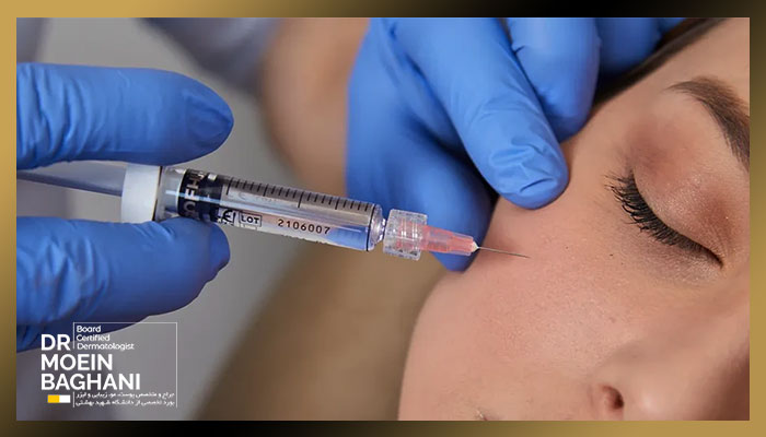 تزریق پروفایلو