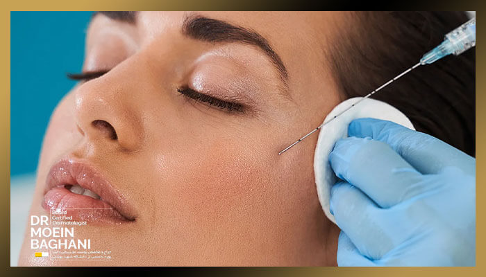 لن لوما Lanluma