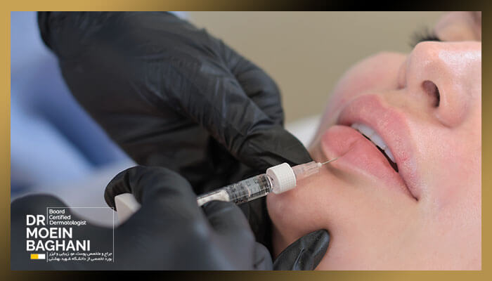 تزریق ژل لب دخترانه