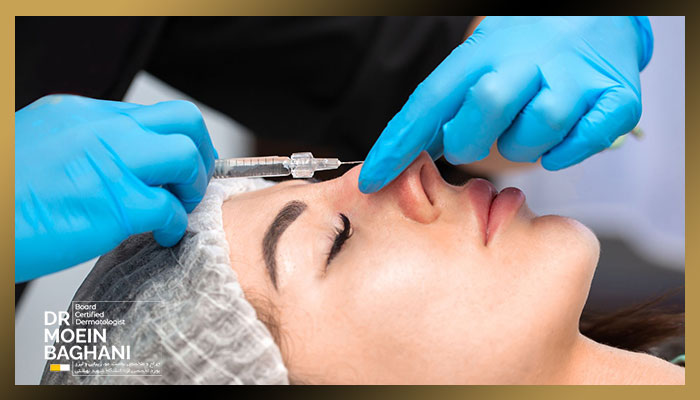 فیلربینی | تزریق فیلربینی